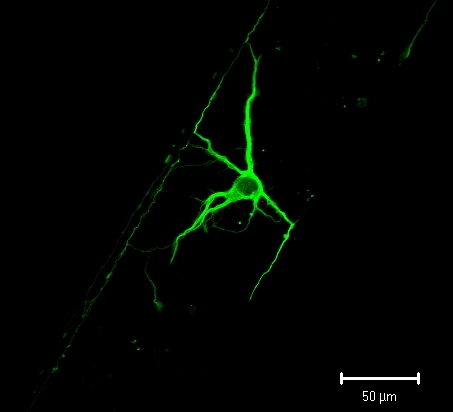 Single Neuron