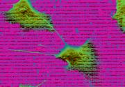 Bindegewebszellen auf laserbehandelter Teflonoberfläche