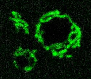 Mitochondrien einer Hefezelle