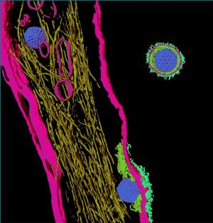 nfektionsvorgang: Herpes Simplex Virus