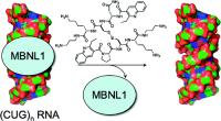 Myotonic muscular dystrophy, MMD