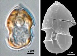 Azadinium spinosum Azadinium spinosum