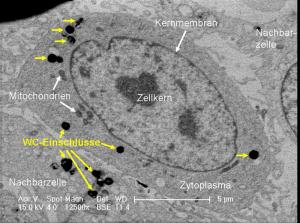 Wolframcarbid-Partikel in Gliazellen