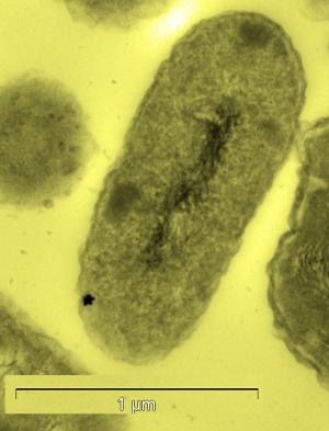 Cupriavidus metallidurans Biomineralisation