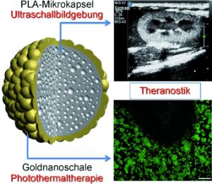 Goldnanoschale als Theranostikum