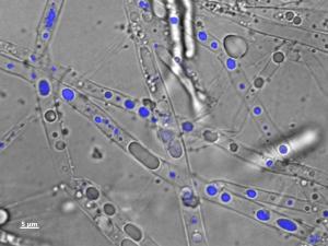 Pythium ultimum Pythium ultimum