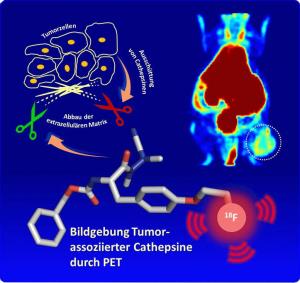 Bildgebung Tumor-assoziierter Cathepsine Bildgebung Tumor-assoziierter Cathepsine